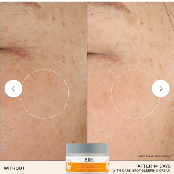 Ren Overnight Glow Dark Spot Sleeping Cream - Picture 2 of 11
